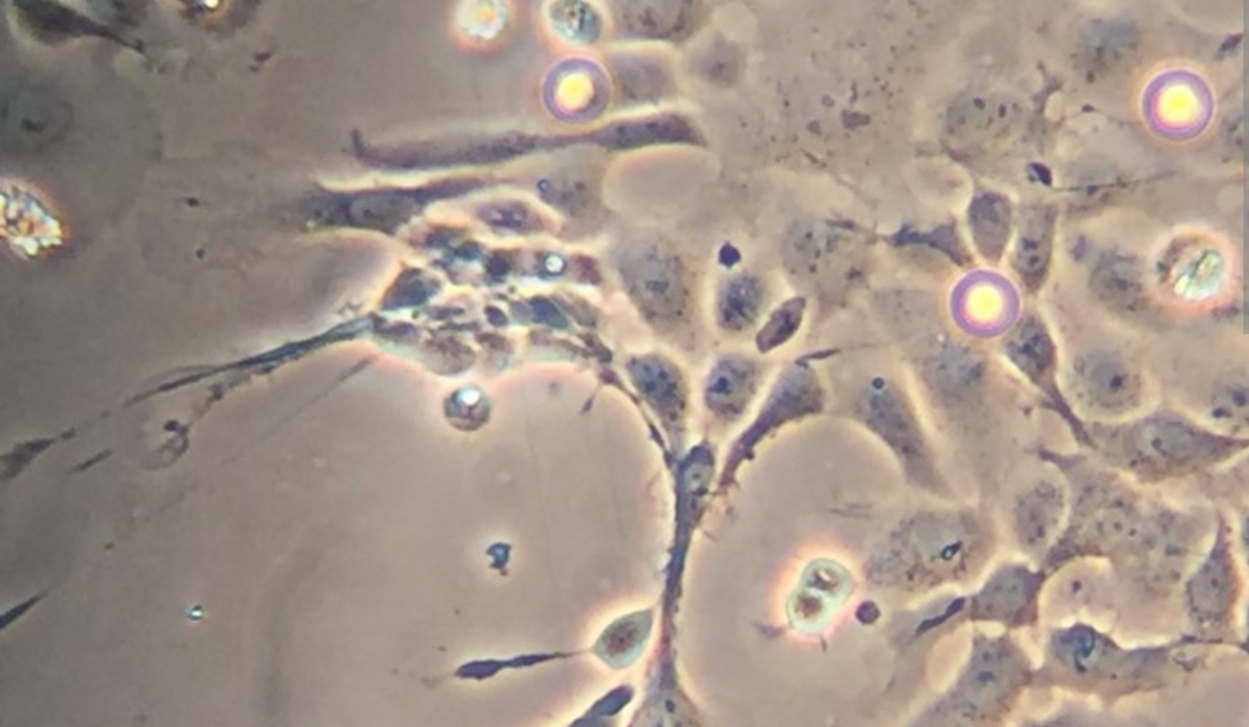 Formaldehyde and milk